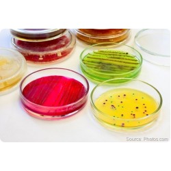 Якість води та сечокам'яна хвороба.