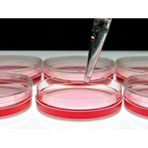 Бактериологический анализ воды из скважины